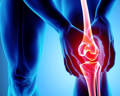 Knee Osteoarthritis Management